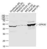 GPR30 Antibody in Western Blot (WB)