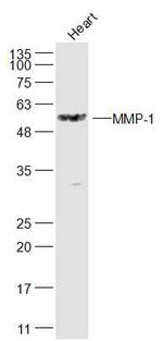 MMP-1 Antibody in Western Blot (WB)