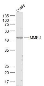 MMP-1 Antibody in Western Blot (WB)