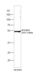 Phospho-GSK-3 Beta (Ser9) Antibody in Western Blot (WB)