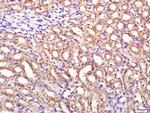 PI3KCA Antibody in Immunohistochemistry (Paraffin) (IHC (P))