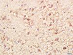 PI3KCA Antibody in Immunohistochemistry (Paraffin) (IHC (P))