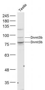 Dnmt3b Antibody in Western Blot (WB)