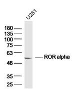 ROR alpha Antibody in Western Blot (WB)