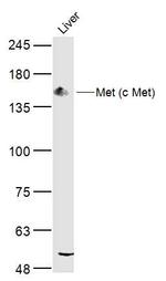 Met (c Met) Antibody in Western Blot (WB)