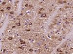 Dopamine D2 Receptor Antibody in Immunohistochemistry (Paraffin) (IHC (P))