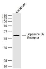 Dopamine D2 Receptor Antibody in Western Blot (WB)