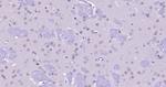 FAK Antibody in Immunohistochemistry (Paraffin) (IHC (P))