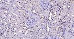 FAK Antibody in Immunohistochemistry (Paraffin) (IHC (P))