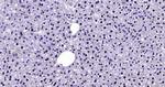 FAK Antibody in Immunohistochemistry (Paraffin) (IHC (P))