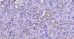 FAK Antibody in Immunohistochemistry (Paraffin) (IHC (P))