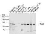 FAK Antibody in Western Blot (WB)