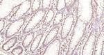 VEGF-C Antibody in Immunohistochemistry (Paraffin) (IHC (P))