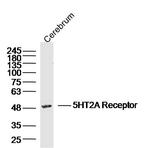 5HT2A Receptor Antibody in Western Blot (WB)