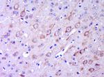 GPR49/LGR5 Antibody in Immunohistochemistry (Paraffin) (IHC (P))