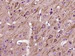 UCP-2 Antibody in Immunohistochemistry (Paraffin) (IHC (P))