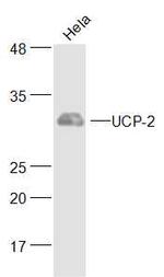 UCP-2 Antibody in Western Blot (WB)