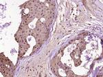 PARP1 Antibody in Immunohistochemistry (Paraffin) (IHC (P))