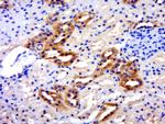 SLC26A6 Antibody in Immunohistochemistry (Paraffin) (IHC (P))