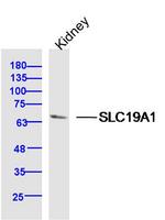 SLC19A1 Antibody in Western Blot (WB)