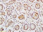 TEM1/CD248 Antibody in Immunohistochemistry (Paraffin) (IHC (P))