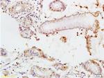 TEM1/CD248 Antibody in Immunohistochemistry (Paraffin) (IHC (P))