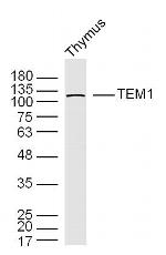 TEM1/CD248 Antibody in Western Blot (WB)