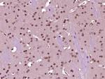 p66 alpha/GATAD2A Antibody in Immunohistochemistry (Paraffin) (IHC (P))