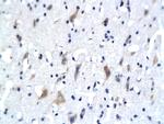 5-HTR3/HTR3A Antibody in Immunohistochemistry (Paraffin) (IHC (P))