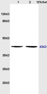 5HT4 Receptor Antibody in Western Blot (WB)