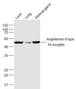 Angiotensin 2 type 1A receptor Antibody in Western Blot (WB)