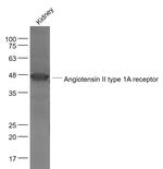 Angiotensin 2 type 1A receptor Antibody in Western Blot (WB)