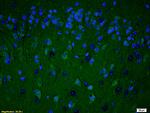 PARP1 Antibody in Immunohistochemistry (Paraffin) (IHC (P))