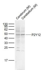 P2Y12 Antibody in Western Blot (WB)