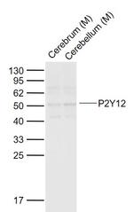 P2Y12 Antibody in Western Blot (WB)