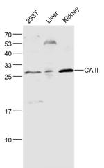 CA II Antibody in Western Blot (WB)