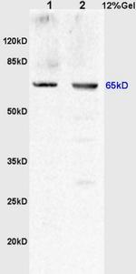 Uromodulin Antibody in Western Blot (WB)