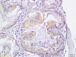 VEGFR3 Antibody in Immunohistochemistry (Paraffin) (IHC (P))