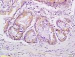 VEGFR3 Antibody in Immunohistochemistry (Paraffin) (IHC (P))