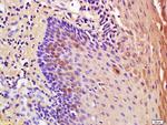 IL-1RA Antibody in Immunohistochemistry (Paraffin) (IHC (P))