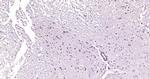IL-1RA Antibody in Immunohistochemistry (Paraffin) (IHC (P))