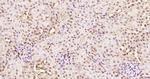 KRG2/DDX11 Antibody in Immunohistochemistry (Paraffin) (IHC (P))