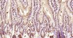 KRG2/DDX11 Antibody in Immunohistochemistry (Paraffin) (IHC (P))