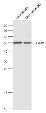 PAX6 Antibody in Western Blot (WB)