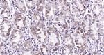 PAR-2 Antibody in Immunohistochemistry (Paraffin) (IHC (P))