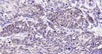 PAR-2 Antibody in Immunohistochemistry (Paraffin) (IHC (P))