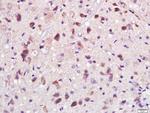 PAK1 Antibody in Immunohistochemistry (Paraffin) (IHC (P))