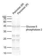 Glucose 6 phosphatase 2 Antibody in Western Blot (WB)