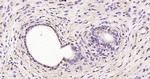 RSL1D1 Antibody in Immunohistochemistry (Paraffin) (IHC (P))