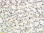 CD162 Antibody in Immunohistochemistry (Paraffin) (IHC (P))